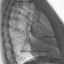 Lateral chest x-ray 1